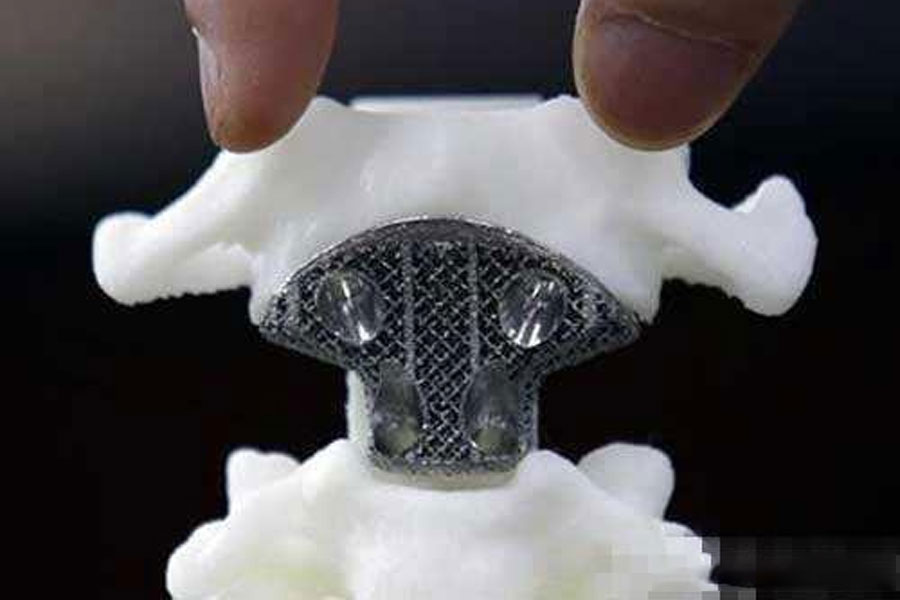 Model d'os imprès en 3D